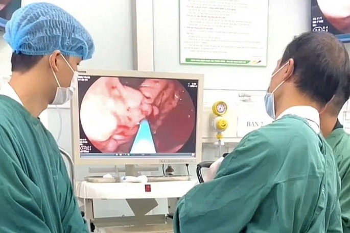 Các bác sĩ thực hiện kỹ thuật tiêm xơ giúp cầm máu hoàn toàn cho bệnh nhân. Ảnh: BVCC