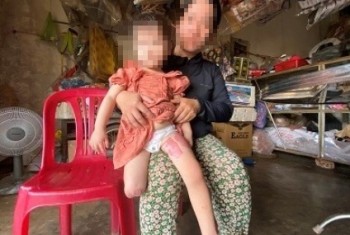 dien-bien-moi-vu-xe-tai-cuon-chau-be-3-tuoi-hong-2-chan-o-gia-lai-cong-an-xem-xet-lai-don-kien-nghi